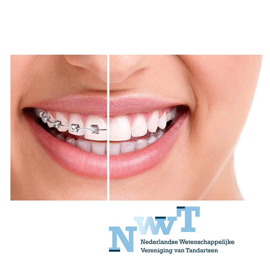 Featured image for “Orthodontie – Je gaat het pas zien als je het doorhebt (Johan Cruijff©️) – NWVT CURSUS – 29 november 2023”